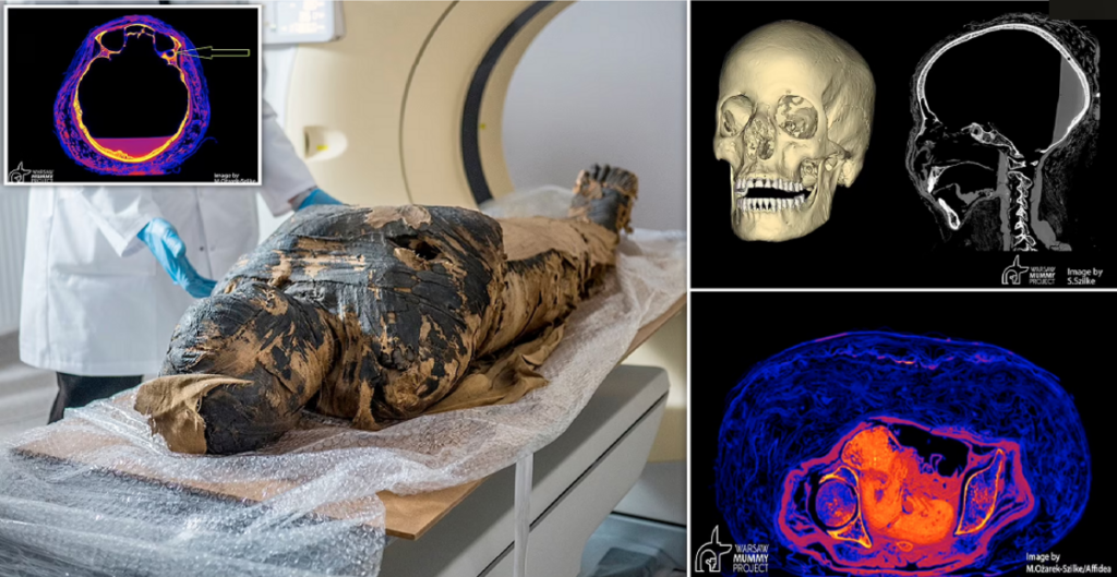 Horrified about the ancient Egyptian mummy discovered pregnant for the first time