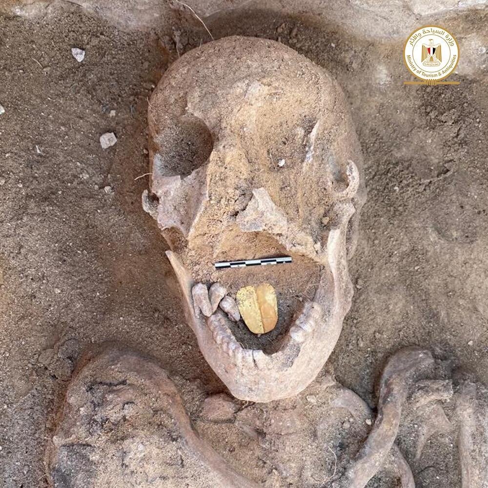 Tongue removed from 2,500-year-old man and woman, replaced with “golden tongue”