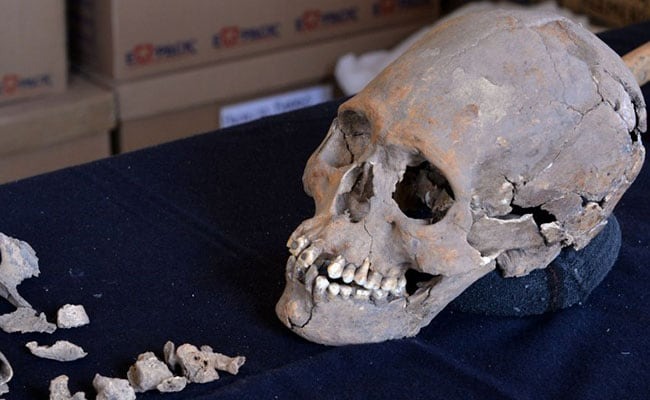 skeleton with stone teeth afp 65